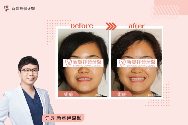 矯正案例