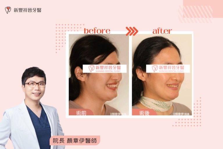 矯正案例