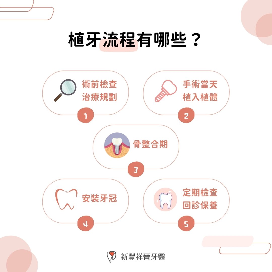 植牙流程有哪些？