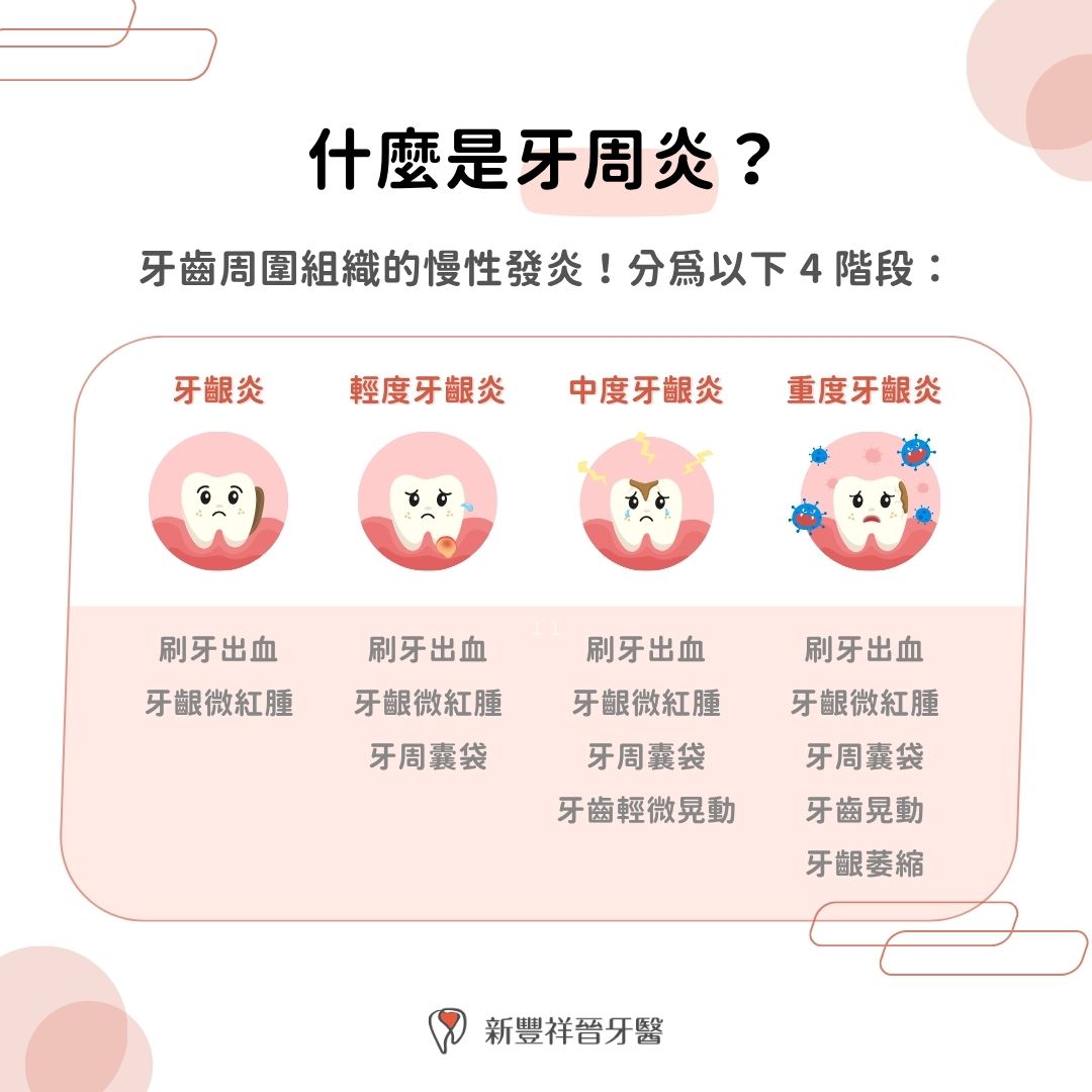 什麼是牙周炎