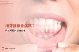 植牙拆線會痛嗎？拆線常見問題總整理