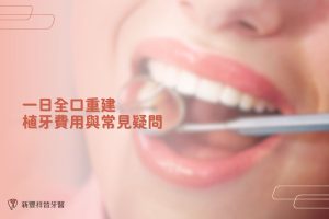 一日全口重建植牙費用與常見疑問