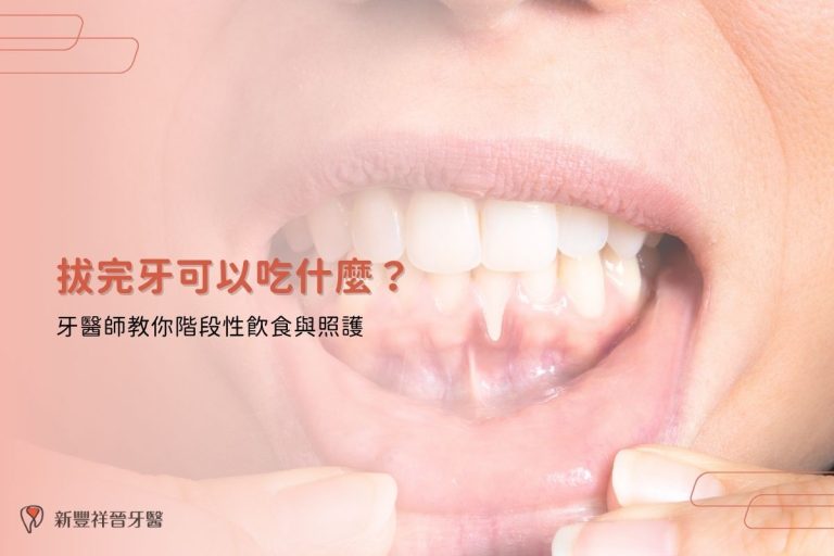 拔完牙可以吃什麼？牙醫師教你階段性飲食與照護