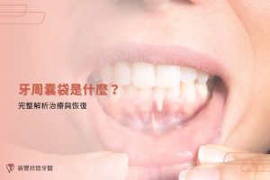 牙周囊袋是什麼？完整解析治療與恢復