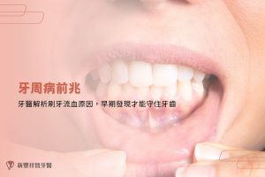 牙周病前兆｜牙醫解析刷牙流血原因，早期發現才能守住牙齒