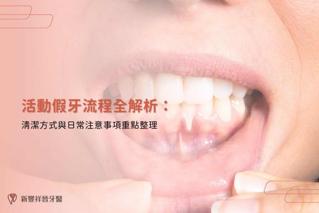 活動假牙流程全解析：清潔方式與日常注意事項重點整理