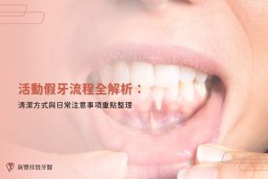 活動假牙流程全解析：清潔方式與日常注意事項重點整理