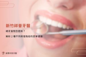植牙食物怎麼挑?解析 2 種不同修復階段的菜單建議