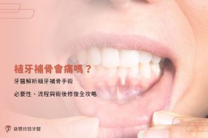 植牙補骨會痛嗎?牙醫解析植牙補骨手術必要性、流程與術後修復全攻略