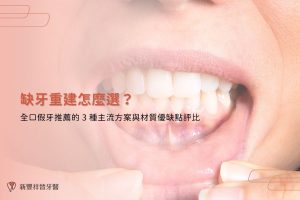 缺牙重建怎麼選？全口假牙推薦的 3 種主流方案與材質優缺點評比