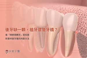 後牙缺一顆,植牙還是牙橋?看「隔壁兩顆牙」就知道|新豐祥晉牙醫