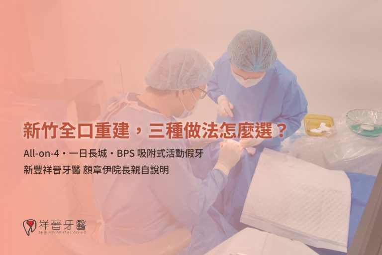 新竹全口重建 三種做法怎麼選 All-on-4 一日長城 BPS 顏章伊院長親自說明 新豐祥晉牙醫