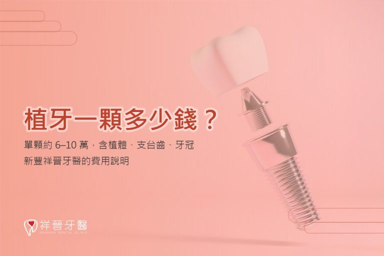 植牙一顆多少錢?單顆約 6–10 萬,含植體、支台齒、牙冠|新豐祥晉牙醫