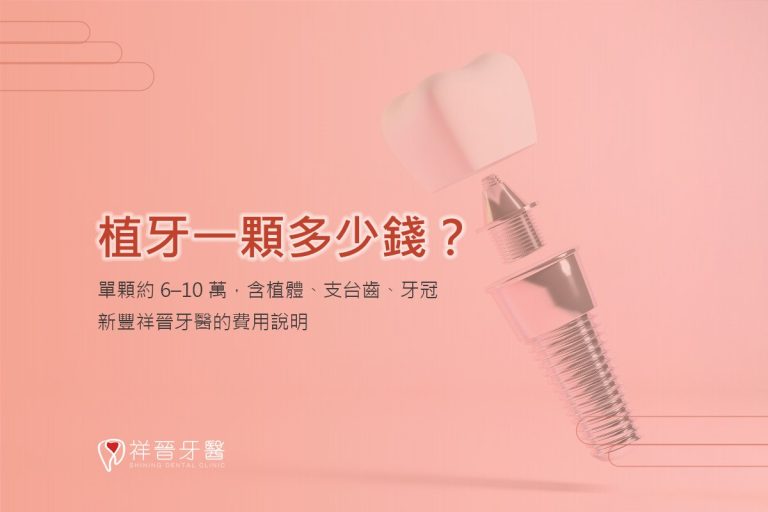 植牙一顆多少錢?單顆約 6–10 萬,含植體、支台齒、牙冠|新豐祥晉牙醫