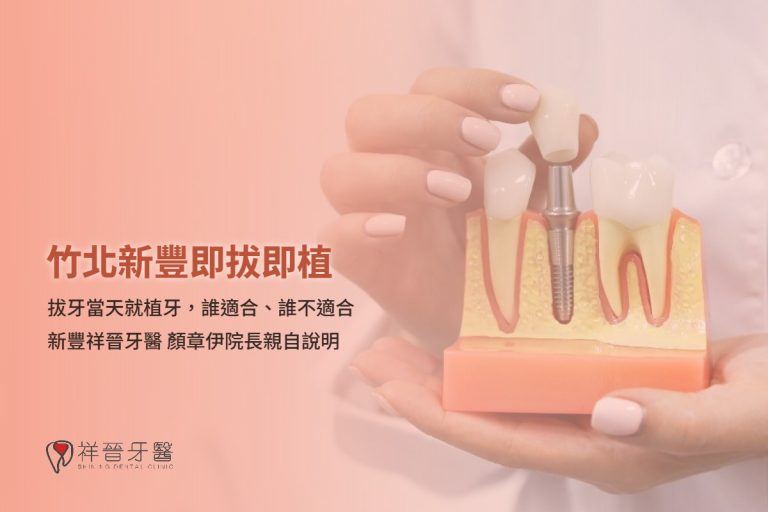 竹北新豐即拔即植 拔牙當天就植牙 誰適合誰不適合 顏章伊院長 新豐祥晉牙醫